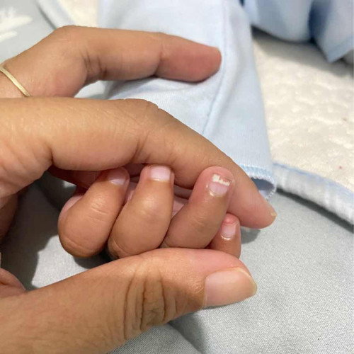 Kuku bayi ada putih putih ya