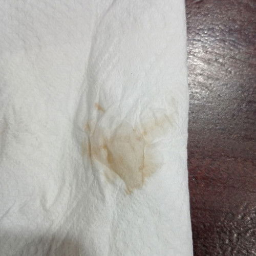 มีน้ำสีเหลืองๆติดกางเกงใน