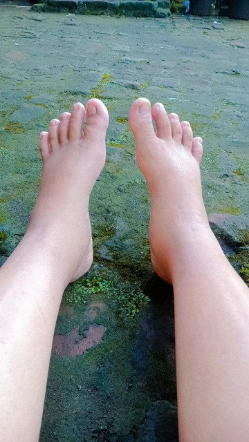 kaki bengkak