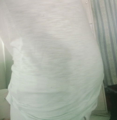 Bun 21 week prut baru Sgede ini normal gak si Bun,kpkiran bnget,,nunggu pksu gajian Bru USG,