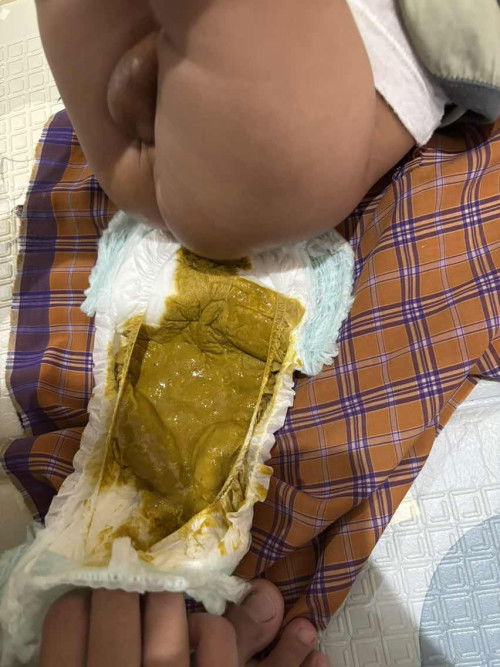 Pup Bayi 5 bulan
