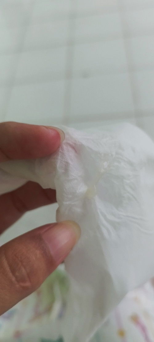 Keluar lendir hamil 37 week 1 hari tapi ga sama darah. Itu kira" kenapa atau hanya keputihan