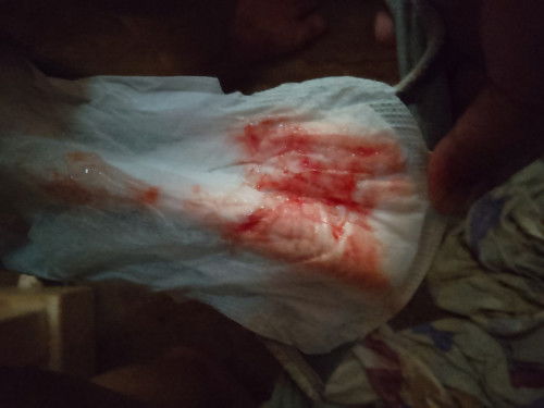 Mau nanya sekitar lahiran bundaaaa🙏