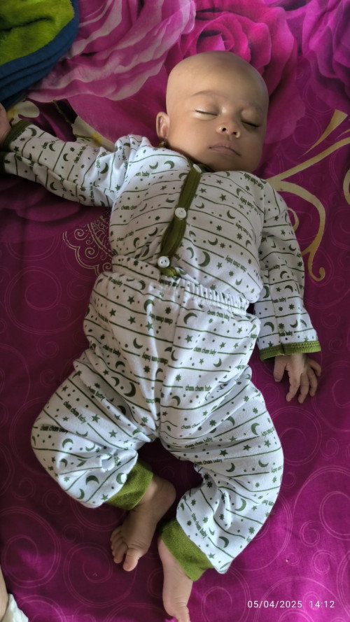 Bayi 1.5 bulan masih banyak tidur apakah wajar?