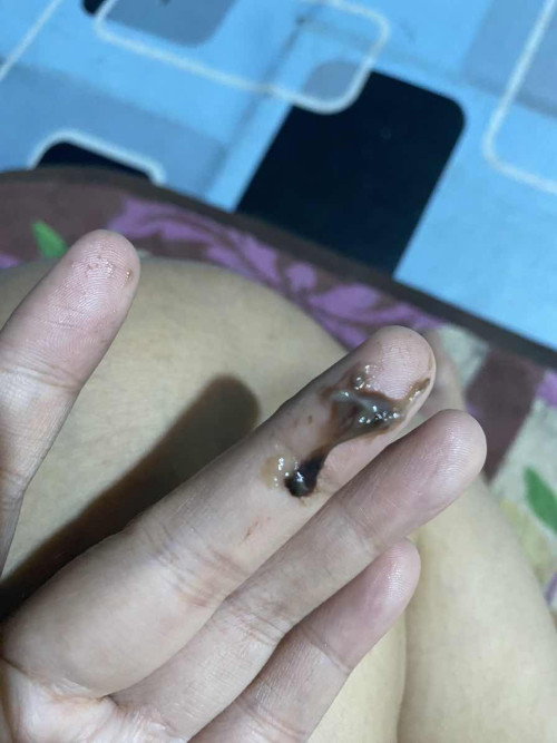 Keluar flek coklat