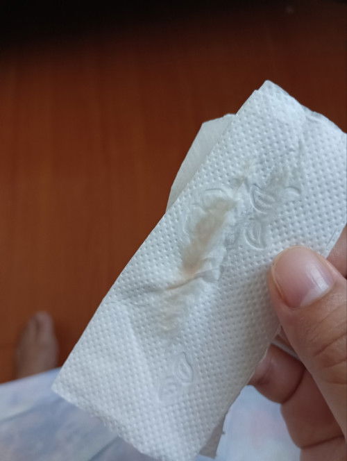Normal discharge po ba eto? 33 weeks pregnant? Everyorning po ganun pero di buong araw.