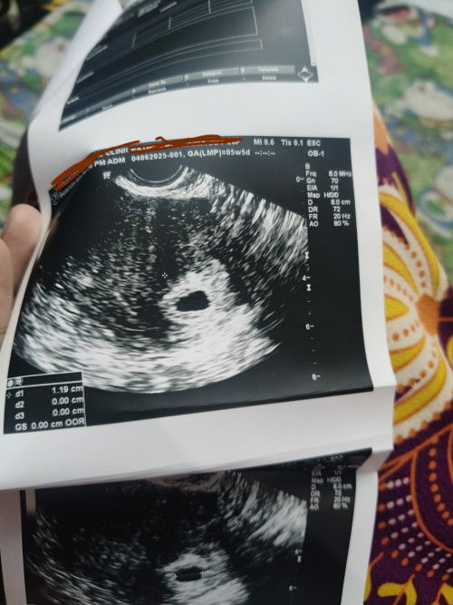 5weeks pregnant