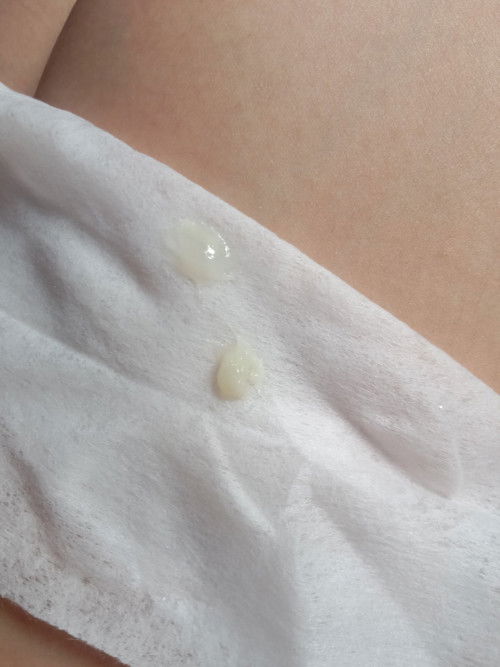 Normal po ba ung ganitong discharge