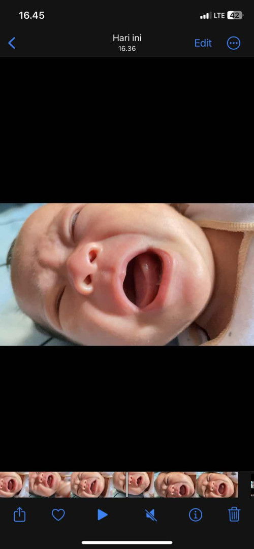 Apakah ini tongue tie?