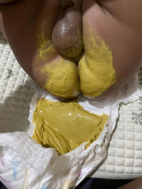 Pup bayi 4 bulan