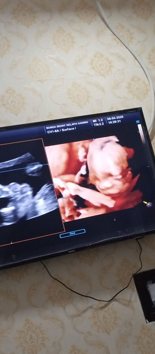 19 week 3 day