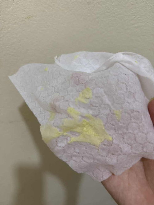Phân bé con 1m7day màu như này có bất thường không ạ?