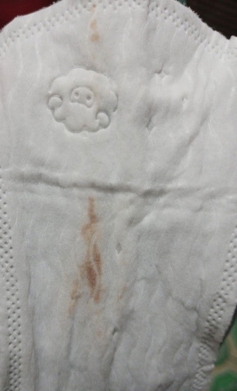 Spotting selepas dapat result positive 2 hari yang lalu