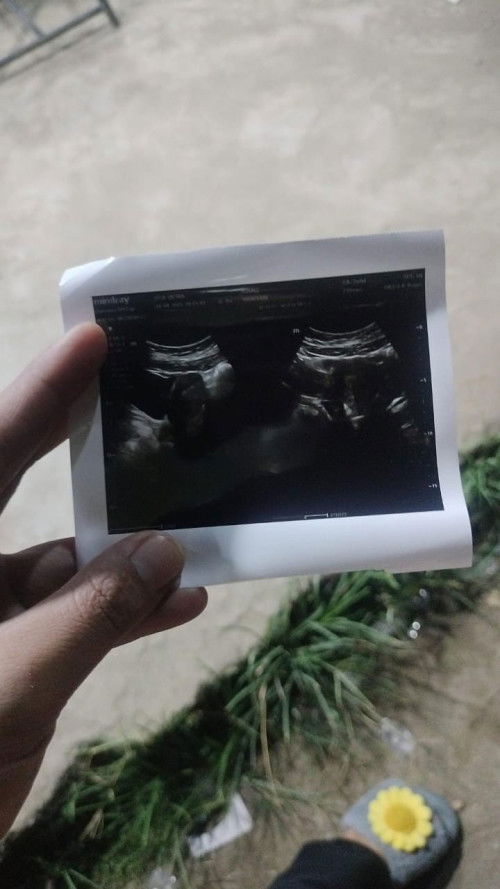 Mau nanya bunda, ini pertanda apa ya bunda, kalau misal nya hamil, itu tanda nya gimana bunda