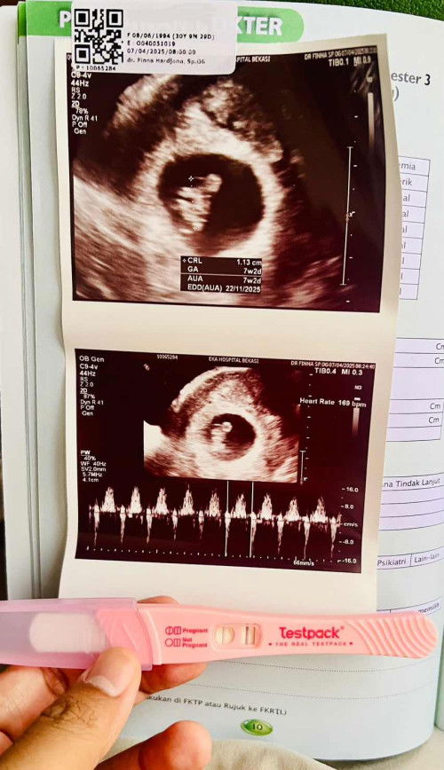 USG TRANSVAGINAL FLEK