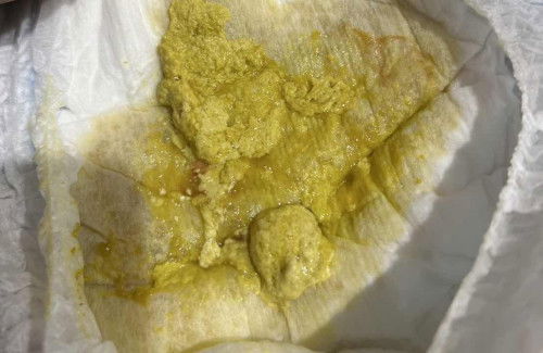 ขอความเห็นจากแม่ๆคะ