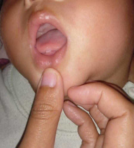 Tumgi bayi 9bulan 26 hari