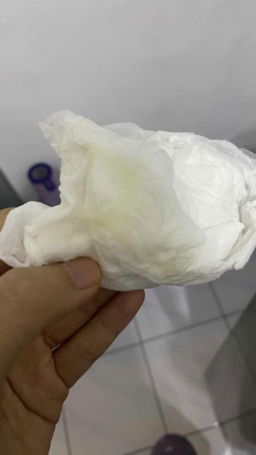 Keluar lendir tapi belom ada mules