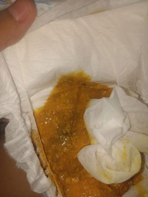 Tanya tentang pup bayi 1 bulan apa ini normal atau tidak