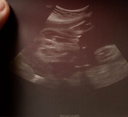 boy or girl