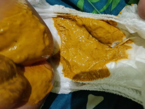 Bunda" Mau tanya dong