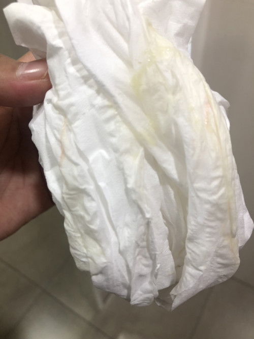 Mau tanya kalo kaya gini normal gak ya bund , usia kandungan 23 week ada bercak merah sedikit ?