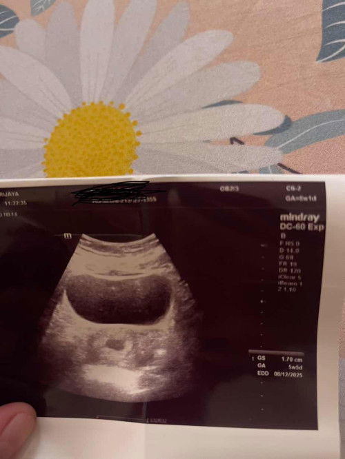 Tarikh LMP dengan scan berbeza