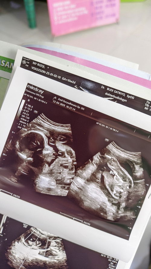 Jenis Kelamin Bayi
