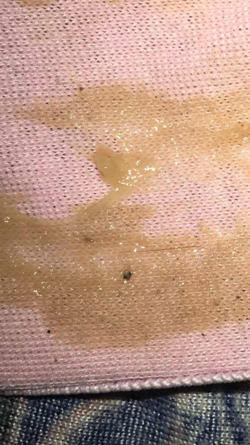 Mucus plug ba to mga mi??