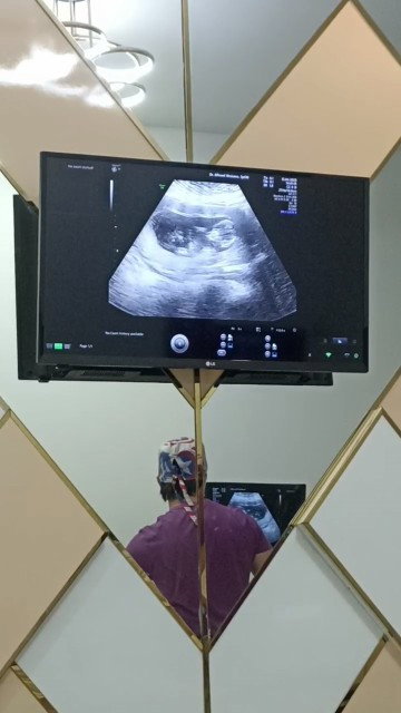 gambar usg kurang ketuban itu kek gmn sih