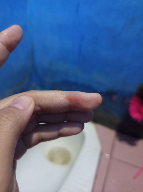 Kira2 ini kenapa ya tidak ada gejala sama sekali ada yg bsa kash saran?