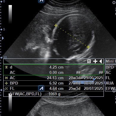 28-29 week