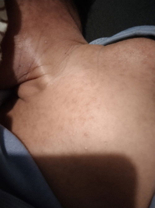 Halo Bun mau nanya ini bayi saya kulit nya bintik merah2 banyak, begini kenapa ya bun