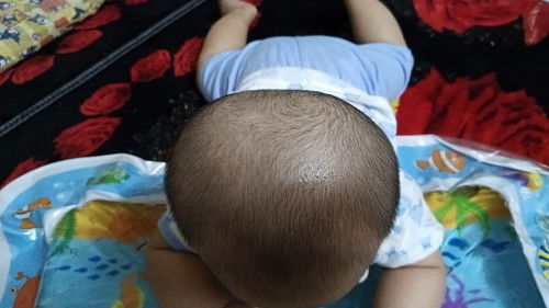 Kepala baby 4M