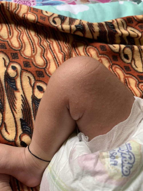 bayi 25 hari