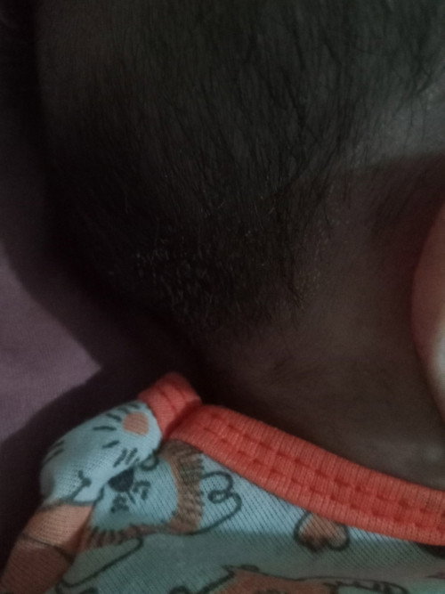 Putih-putih menempel di rambut bayi