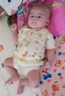 kepala bayi seperti berbando