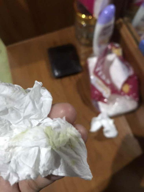 Keputihan dari awal hamil disertai rembesan