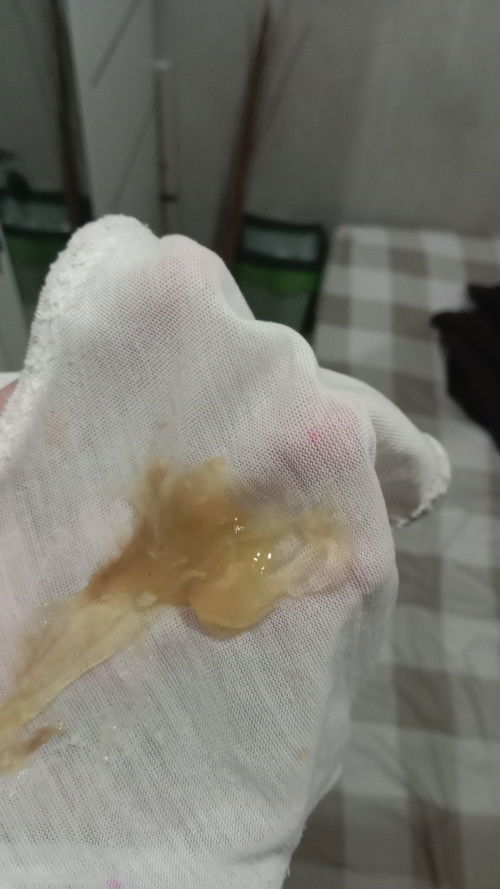 keluar cairan dan kotraksi