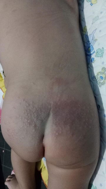 Ruam Popok