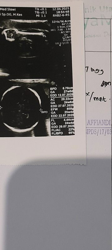 Tanya USG selisih 3 minggu