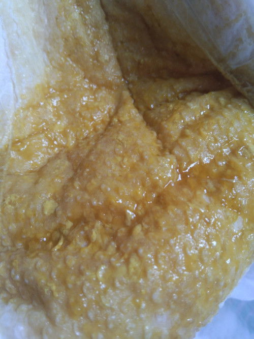 น้องอายุ 1 เดือนกับอีก 20 วันกินนมแม่ 100%มีอาการถ่ายเป็นน้ำแบบนี้ปกติไหมคะ