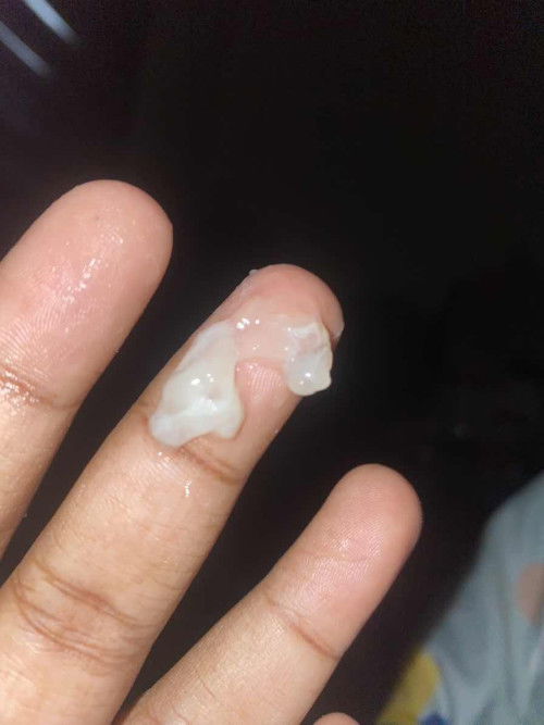 mucus plug