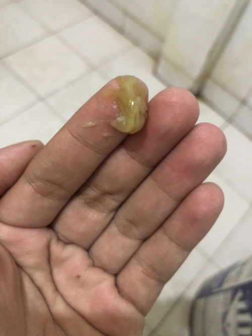 พึ่งคลอด1เดือน10วัน