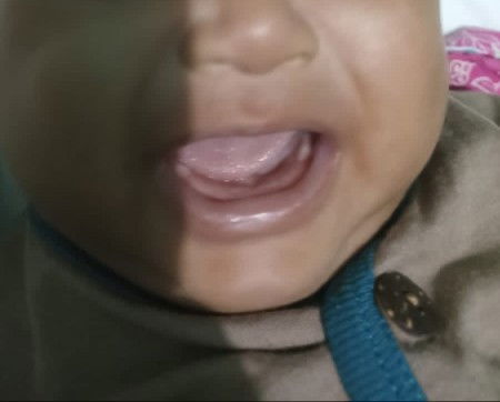 Tumbuh gigi