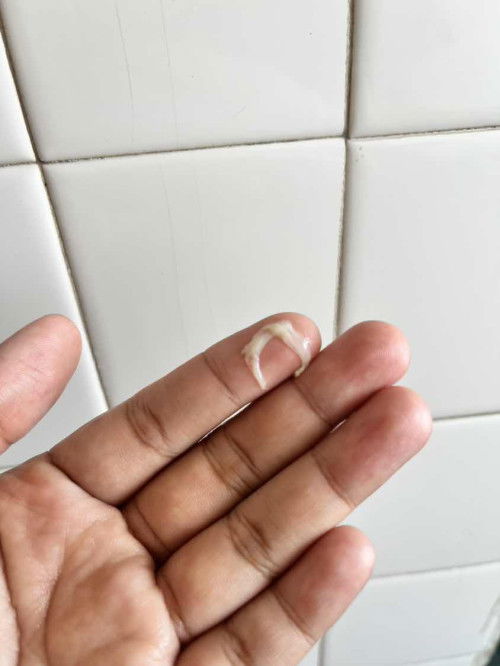 Vaginal discharge