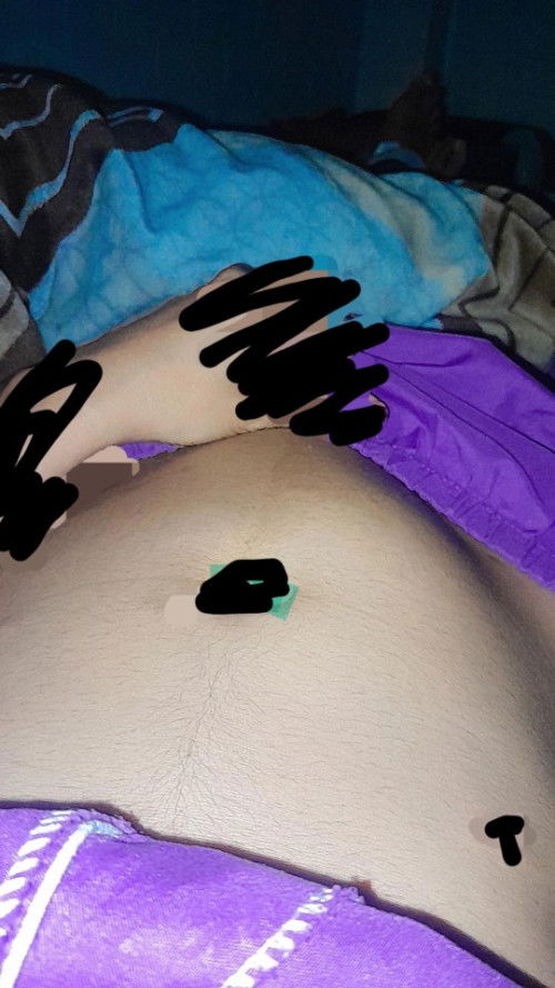 Ada yg tau ini kenapa bisa gini ? Hamil 19minggu tapi perut kadang keras bahkan sampai menonjol