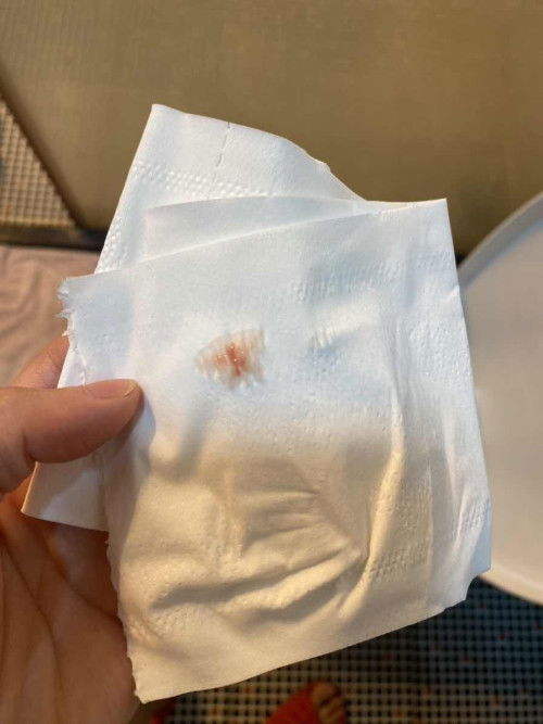 Chào các mom. Em bầu 9tuần 2 ngày. Hnay thấy ra dịch màu hồng mà lo lo k biết có sao k các mom nhỉ