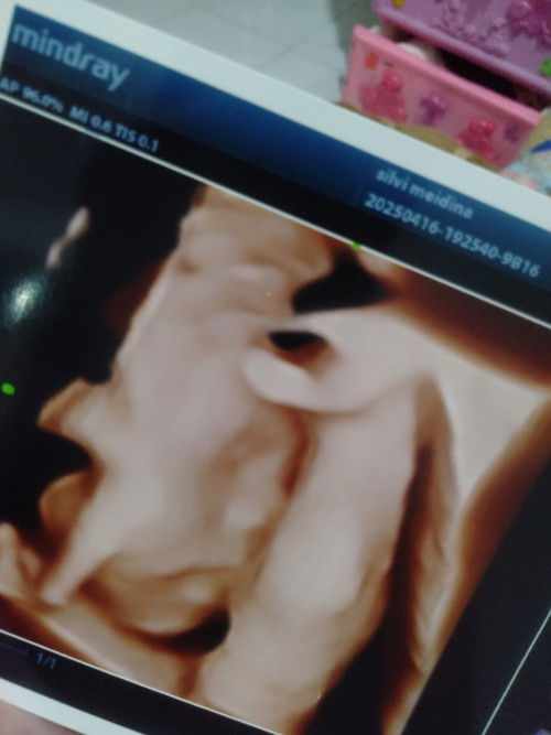 28week kesayangan Ibu bapak😍🤗