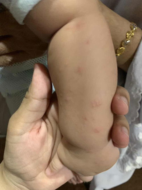 Side effect cucuk baby 5 bulan